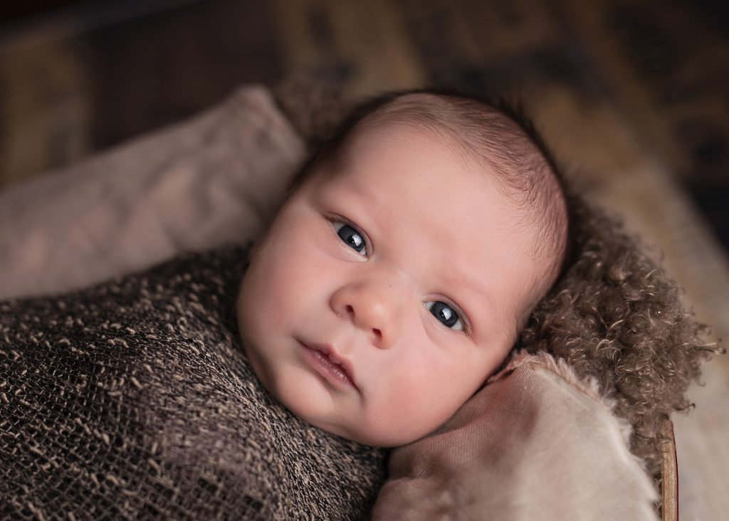 Why Would A Baby Be Cross Eyed